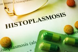 Гистоплазмоз: симптомы, методы профилактики и лечения