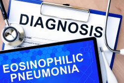 Эозинофильная пневмония: симптомы и лечение