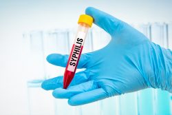 Анализ крови на сифилис: как сдавать и подготовиться к обследованию