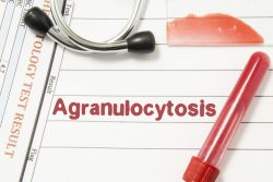 Агранулоцитоз: симптомы, лечение