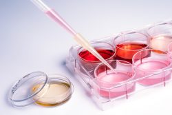 Посев крови на стерильность: показания, стоимость исследования