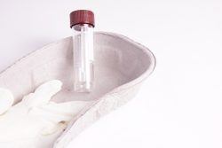 Анализ кала на скрытую кровь: показания, подготовка, методика определения