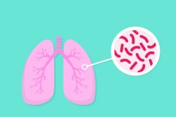 Очаговый туберкулез легких: симптомы, диагностика, лечение