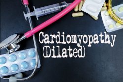 Дилатационная кардиомиопатия: симптомы, диагностика, лечение