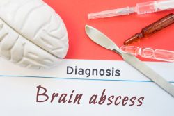 Абсцесс мозга: симптомы, лечение